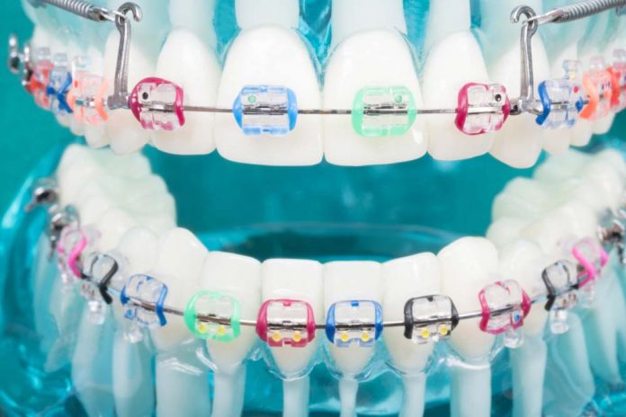 orthodontics Interview with Co-founder of BidMySmile